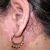 Dermatitis seborreica en las orejas ¿cómo curarla?